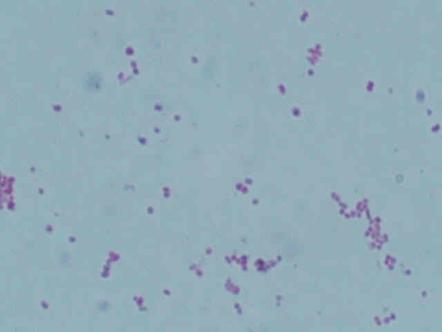 endospore stain