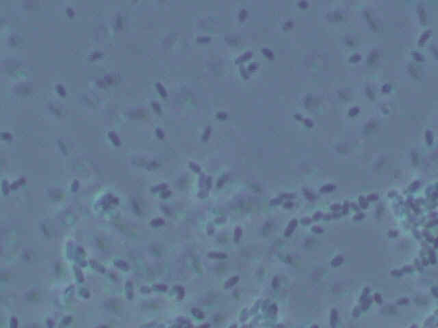 Wet mount of type 1
bacteria