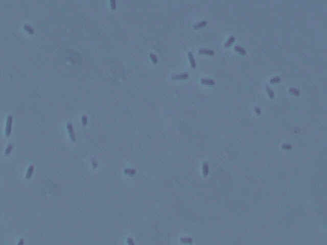 Wet mount of type 2 bacteria