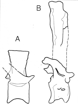 dorsal vertebra